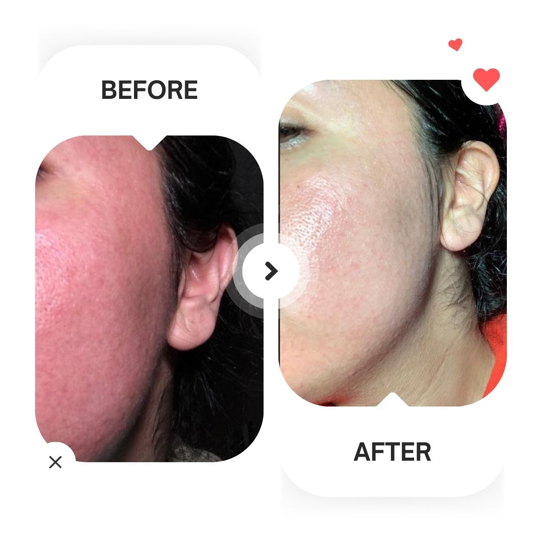 Glycolic Acid 7% Exfoliating Toner (240ml)