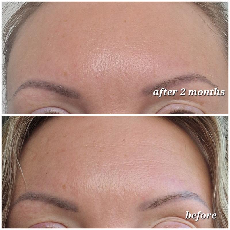 Argireline Botox Solution 10%