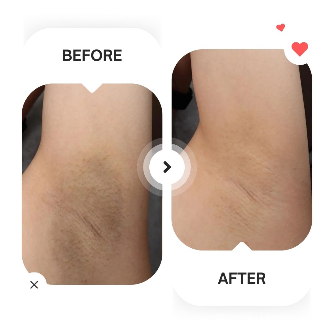 Glycolic Acid 7% Exfoliating Toner (240ml)