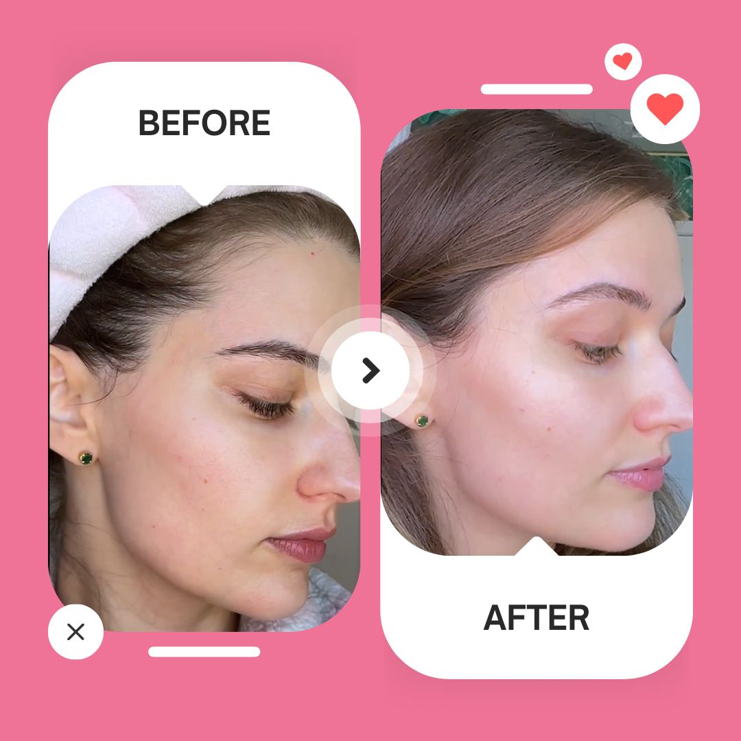 Soothing & Barrier Support Serum