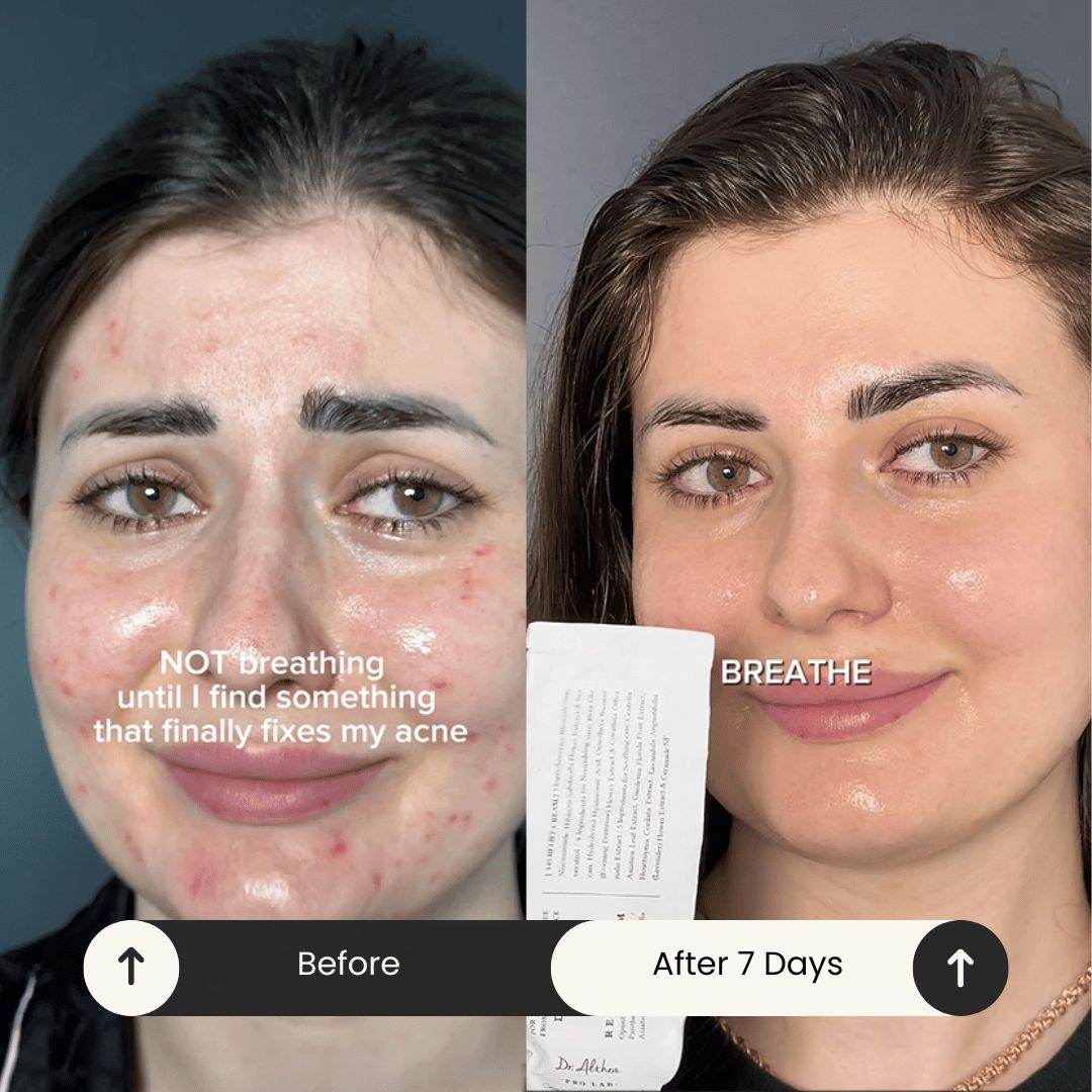 Dr althea 345 Relief Cream 50 ml