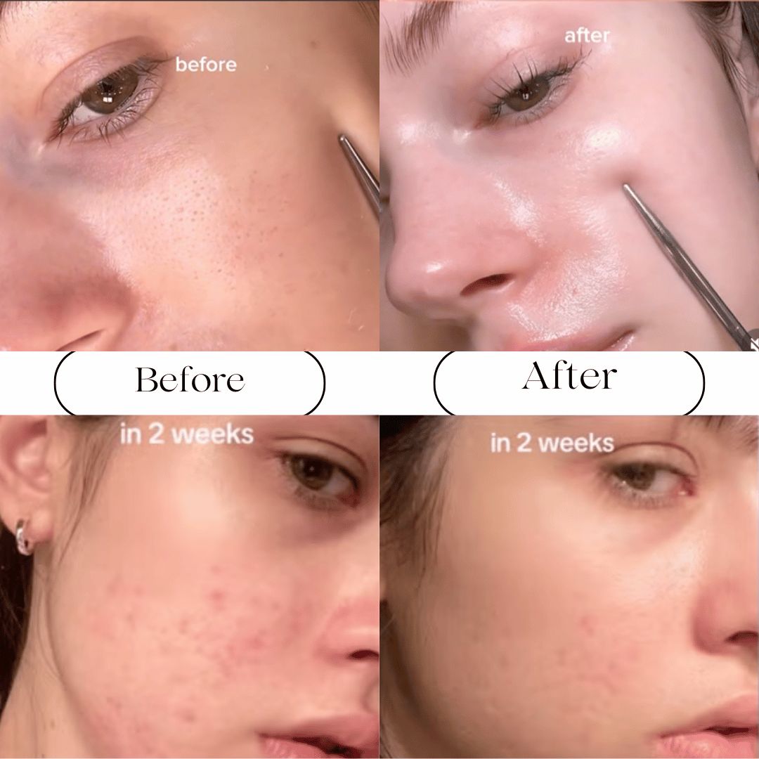 CELIMAX The Vit A Retinal Shot Tightening Booster 15ml