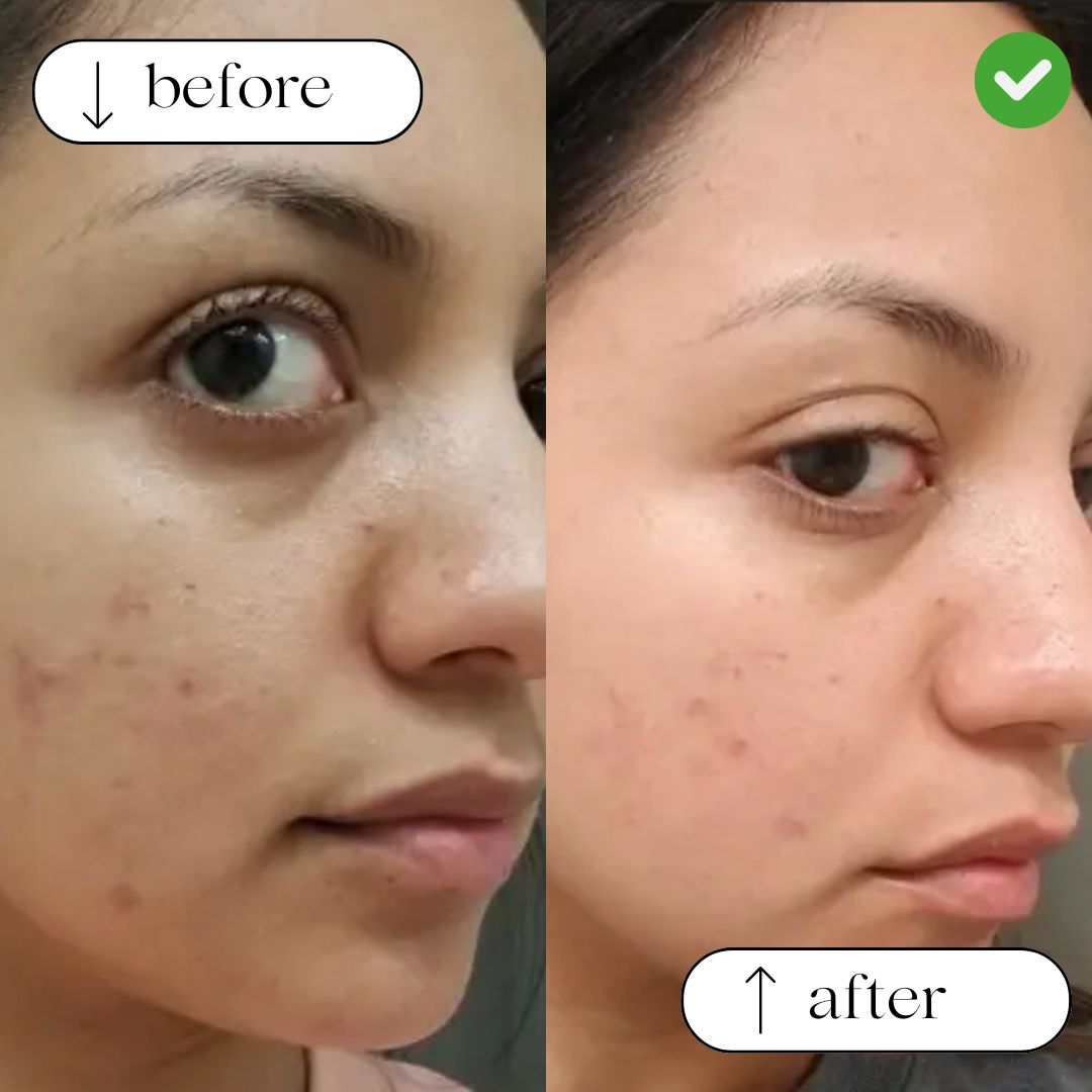 Glycolipid Cream Cleanser