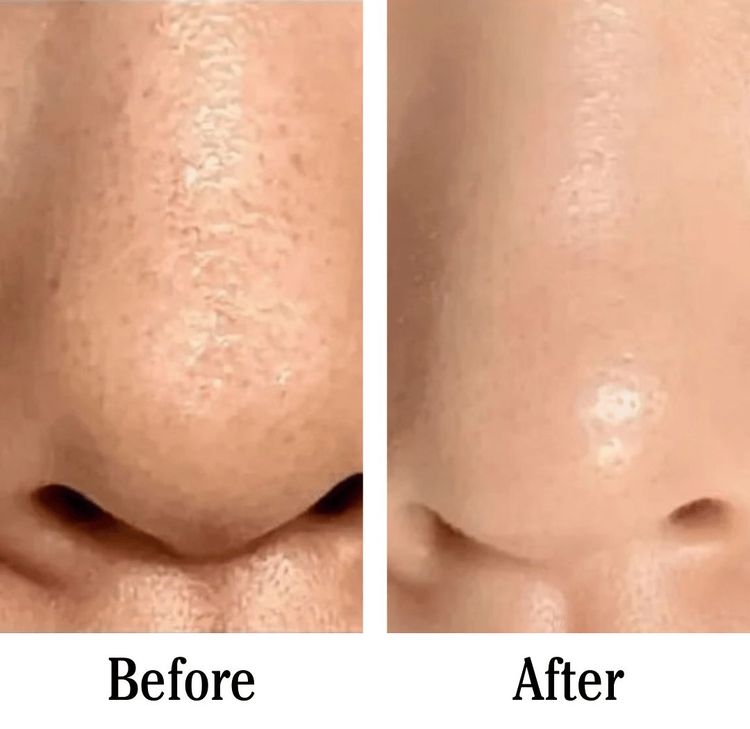 Anua Pore Control Cleasing Oil (200Ml)