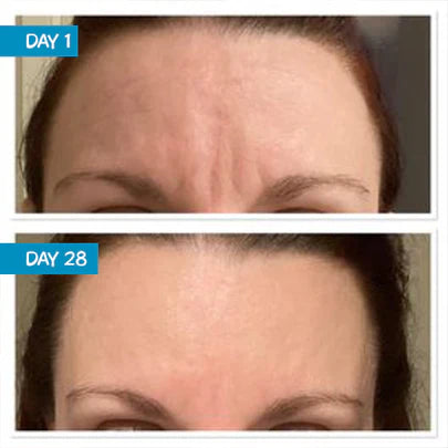 Argireline Botox Solution 10%